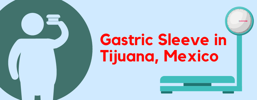 Gastric Sleeve in Tijuana, Mexico